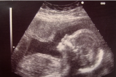 Lire gratuitement Permission de naître publié par Thalia Remmil